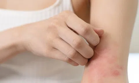 Da cảnh báo hàng loạt bệnh lý nguy hiểm khi trời hanh khô