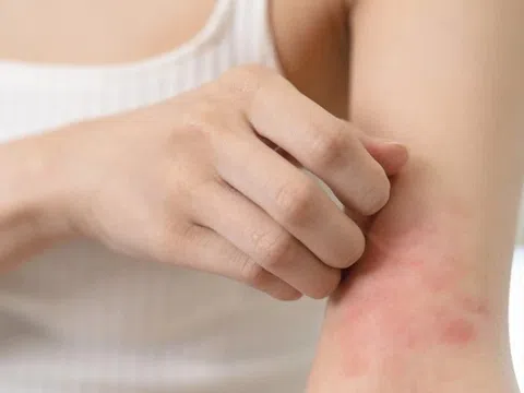 Da cảnh báo hàng loạt bệnh lý nguy hiểm khi trời hanh khô