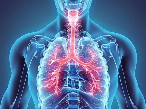 5 cách bảo vệ lá phổi vào mùa đông