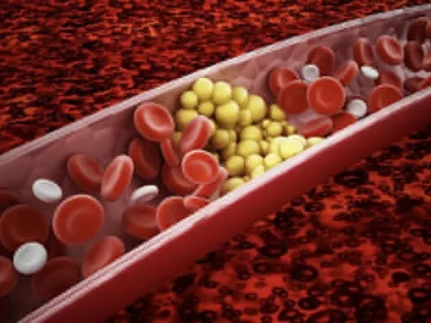 5 lý do khiến mỡ máu tăng cao khi thời tiết lạnh